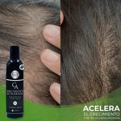 Shampoo Crecimiento Acelerado con Proteínas Capilares