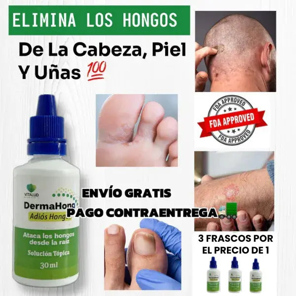 DermaHong || Tratamiento Completo para los Hongos || x3 Frascos