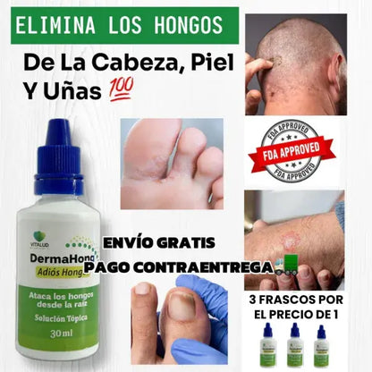 DermaHong || Tratamiento Completo para los Hongos || x3 Frascos